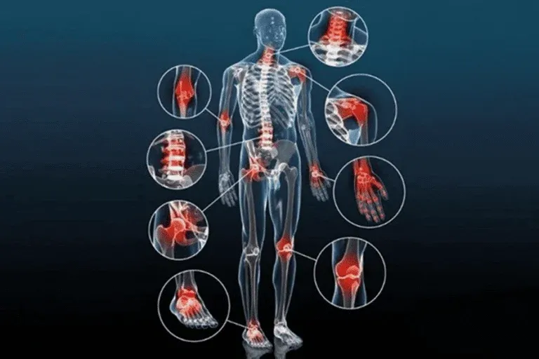 ilustração do esqueleto humano com destaque aos pontos nervosos do corpo na cor vermelha